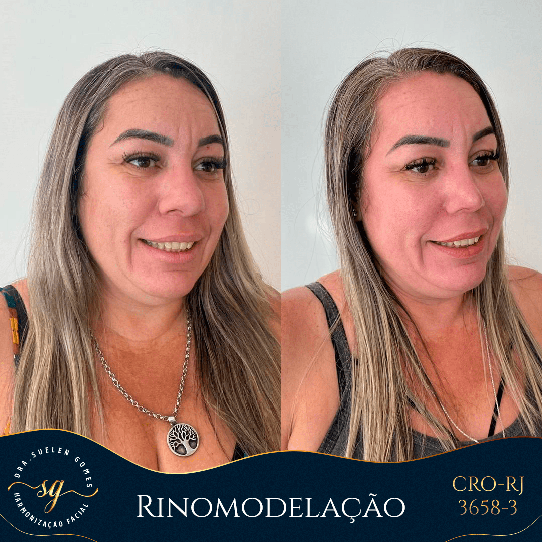 12-06-feed